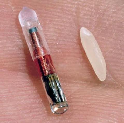 implant puce electronique
